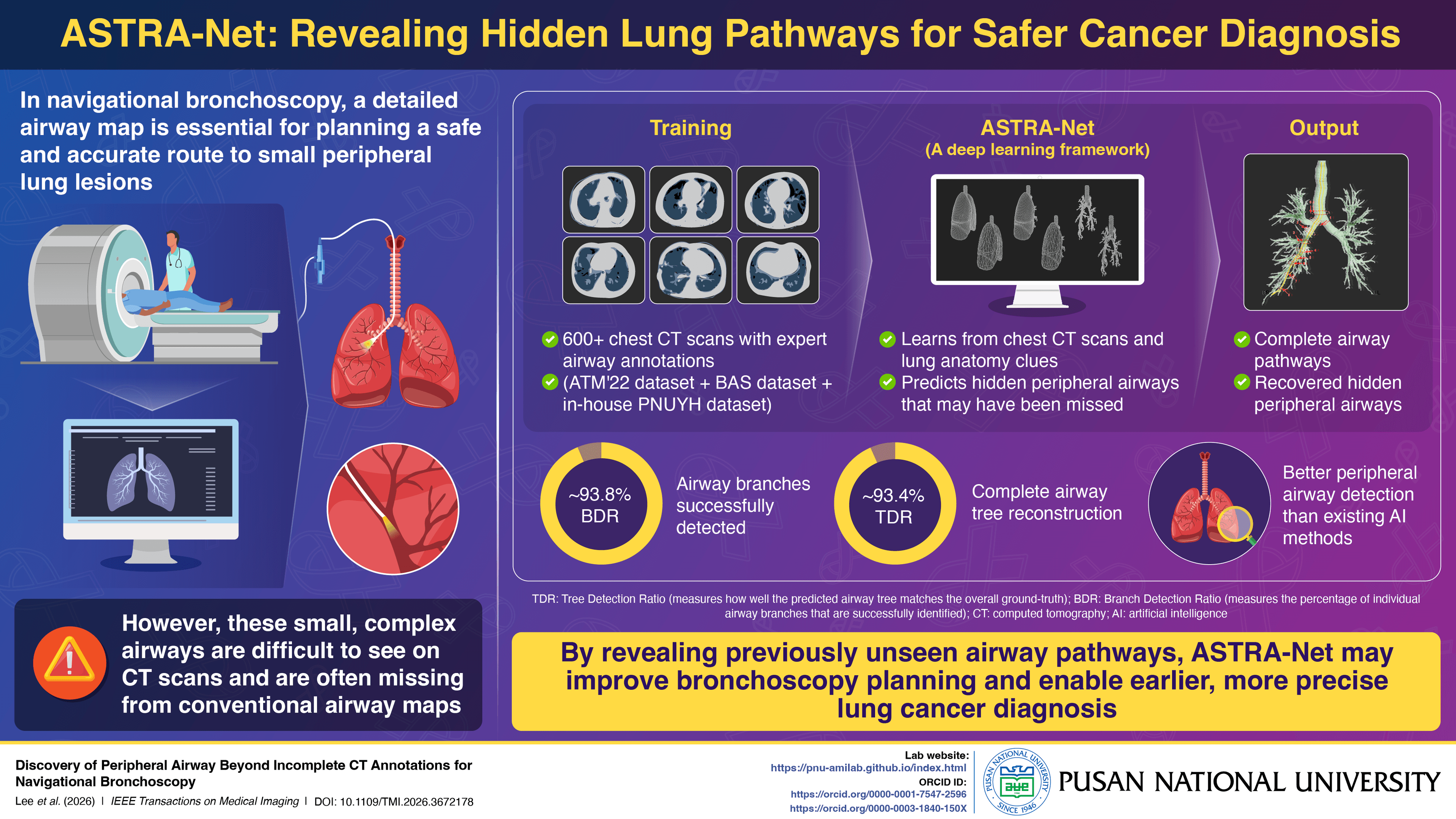 A flyer showing how this ai tool finds parts of the lung CT scans miss