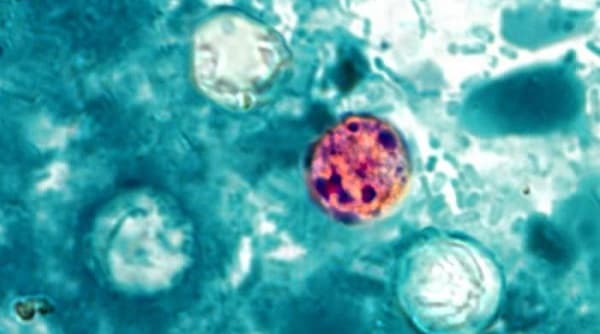 bacteria in a microscope
